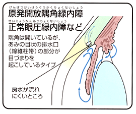 JpΓ@ሳΓȂ